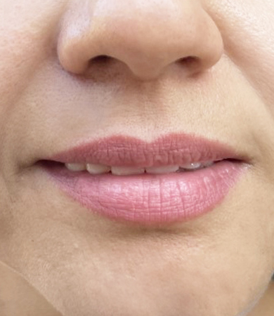 micropigmentacion de labios